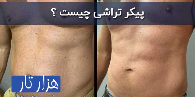 استفاده دستگاه تنس برای لاغری