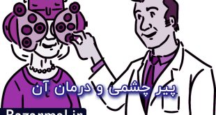 درمان پیر چشمی