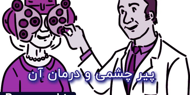 درمان پیر چشمی
